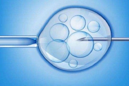 泰国做个试管婴儿多少钱_做试管婴儿需要做输卵管造影吗？-第1张-试管婴儿百科-欣悦国际