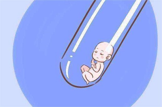 泰国试管婴儿需要什么手续？-第1张-试管婴儿问答-欣悦国际