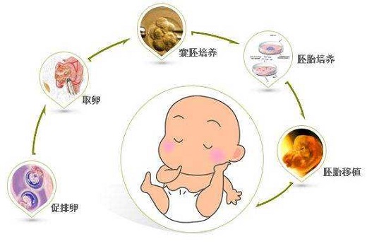 为什么泰国要试管婴儿 为什么泰国试管婴儿好-第3张-试管婴儿问答-欣悦国际
