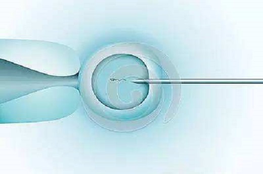 泰国试管婴儿停育案例分享(泰国试管婴儿胚胎停育的原因有哪些)-第1张-试管婴儿问答-欣悦国际